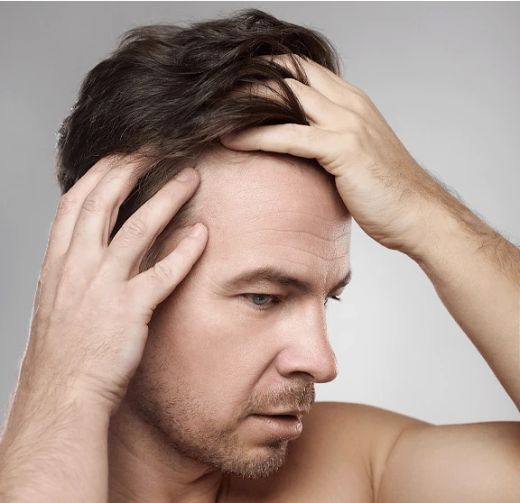 Homme avec des cheveux sains et denses, résultat de Folicerin